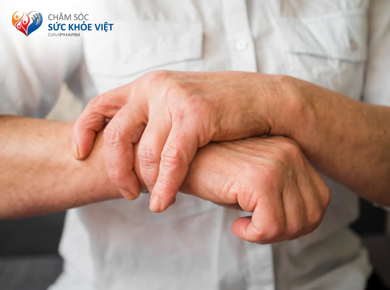 Hiện nay vẫn chưa có phương pháp điều trị dứt điểm viêm khớp vảy nến