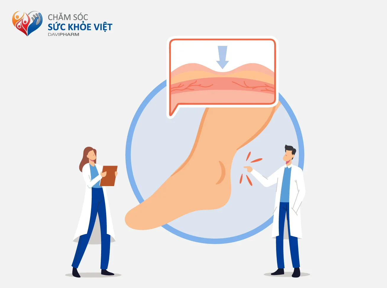 PHÙ DO XƠ GAN: TRIỆU CHỨNG VÀ CÁCH HẠN CHẾ PHÙ
