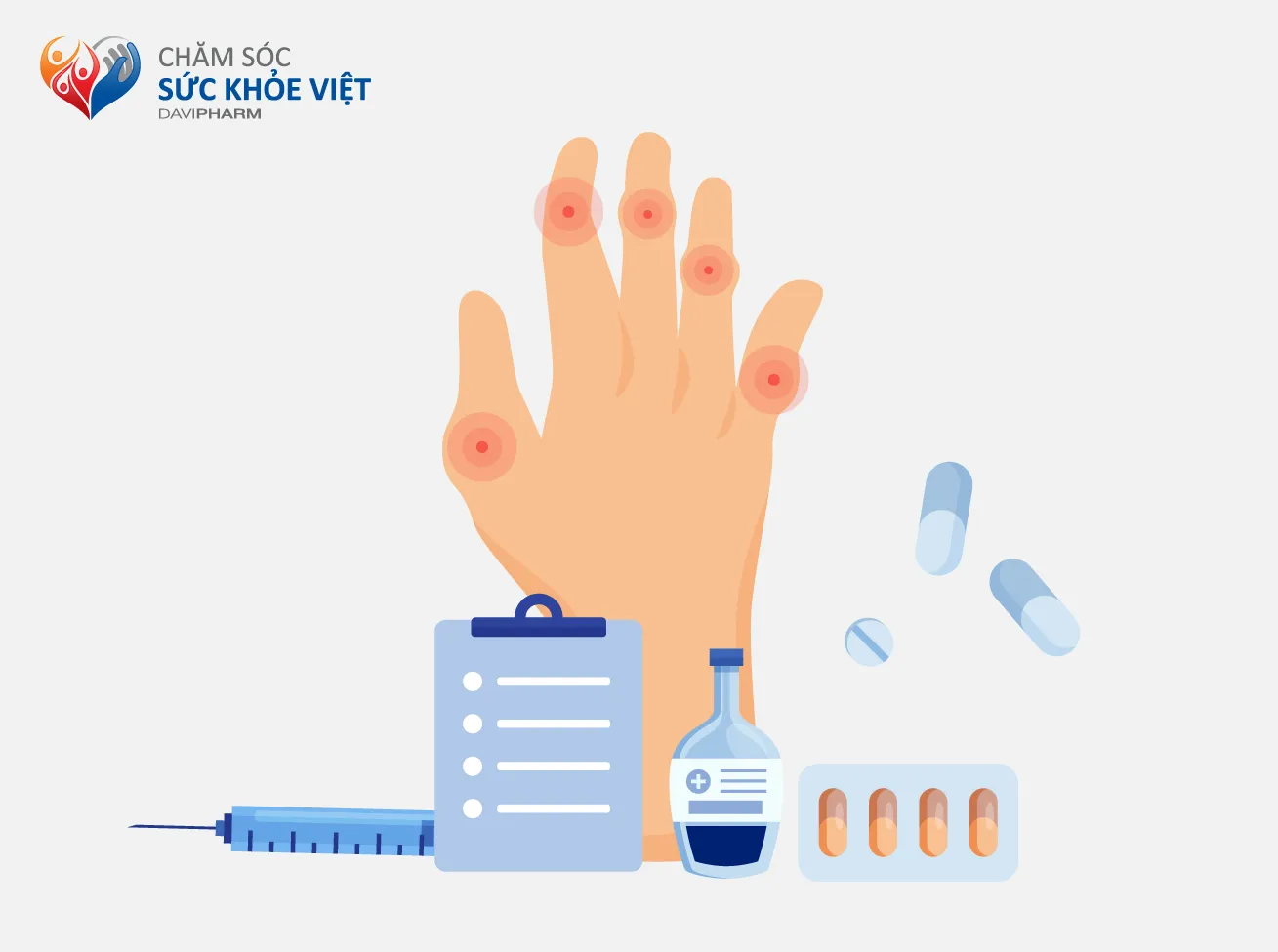 VIÊM KHỚP VẢY NẾN – TRỊ KỊP THỜI, NGĂN TÀN PHẾ