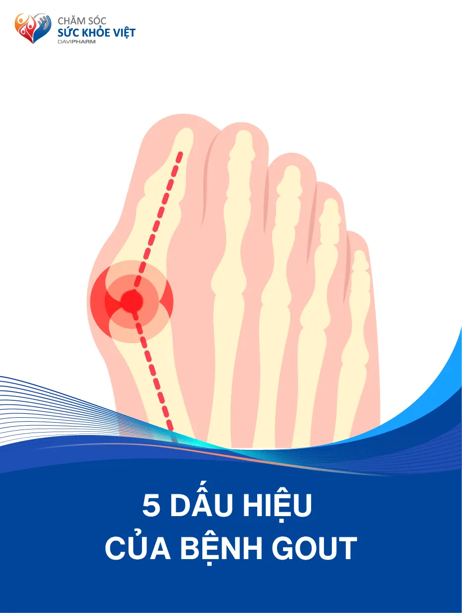 dấu hiệu nhận biết sớm bệnh gout