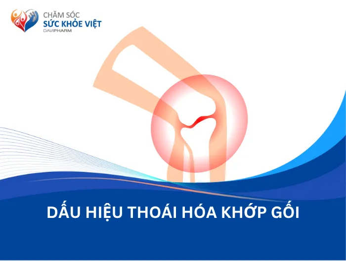 Dấu hiệu thoái hóa khớp gối