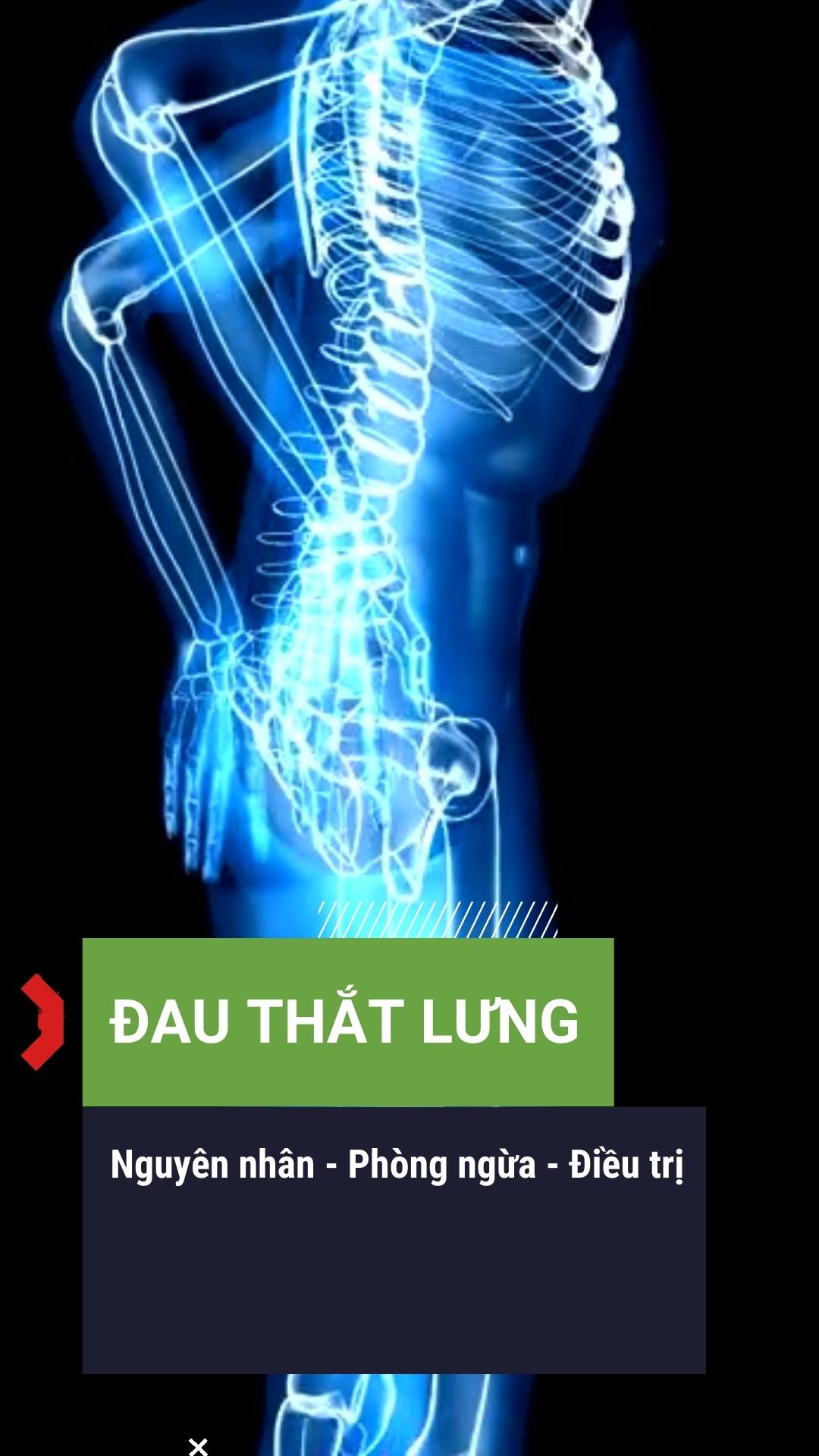 phòng ngừa và điều trị đau thắt lưng