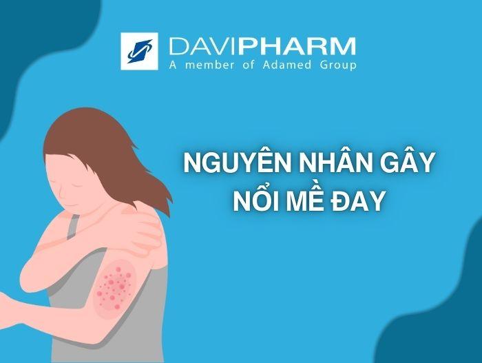 nguyên nhân gây nổi mề đay