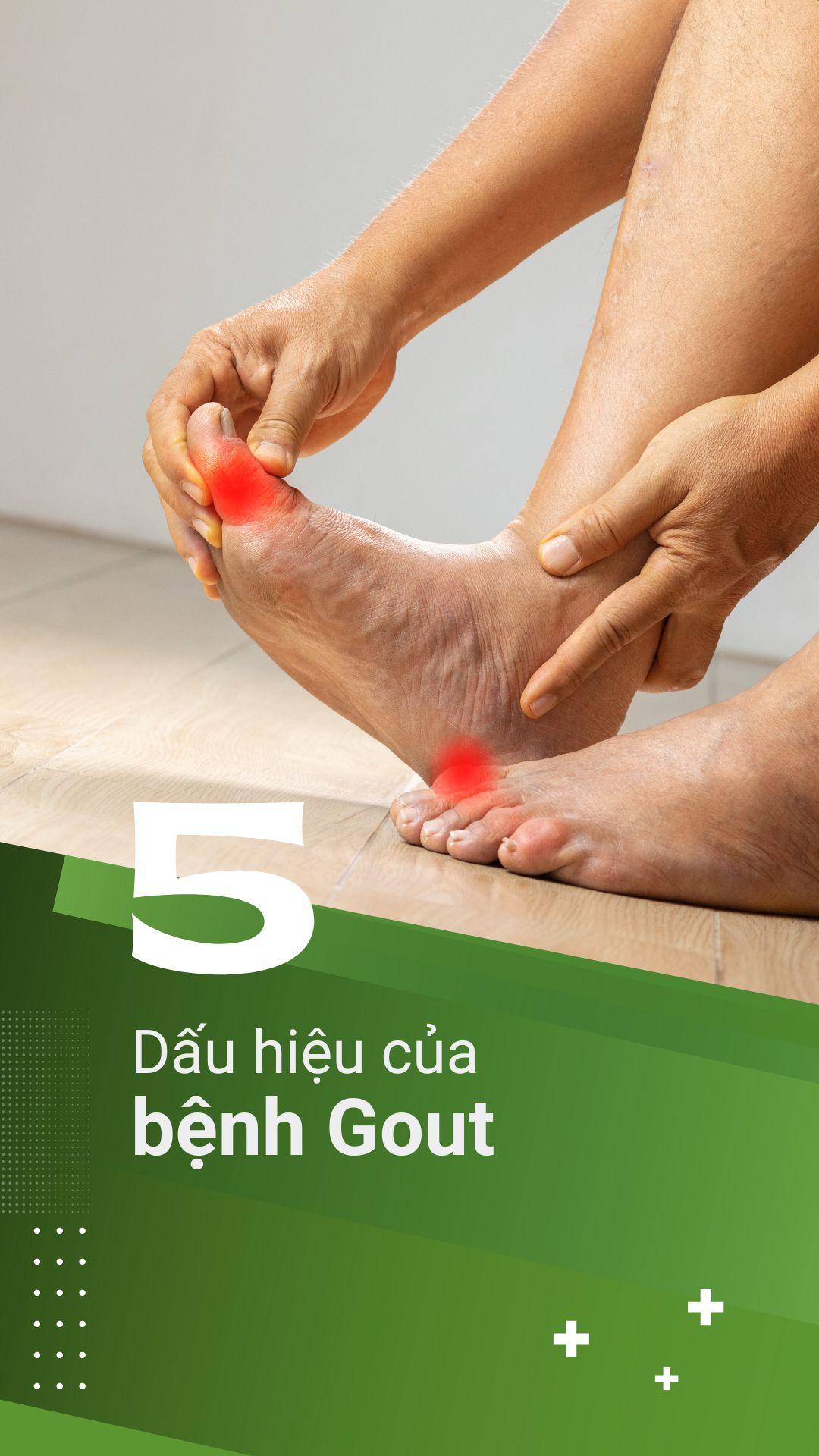 dấu hiệu nhận biết sớm bệnh gout