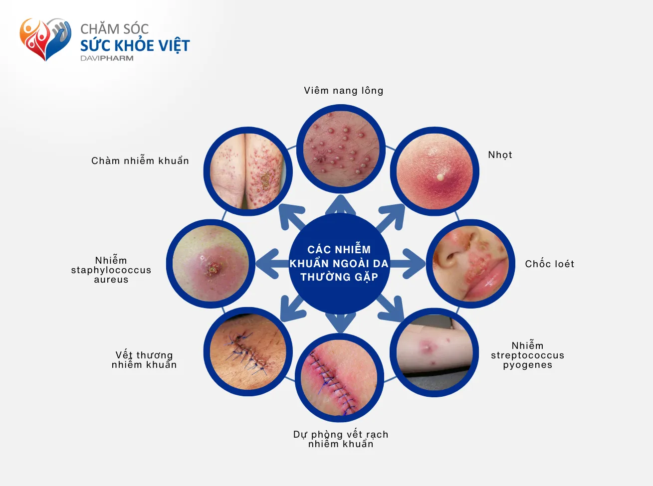 Các nhiễm khuẩn ngoài da thường gặp
