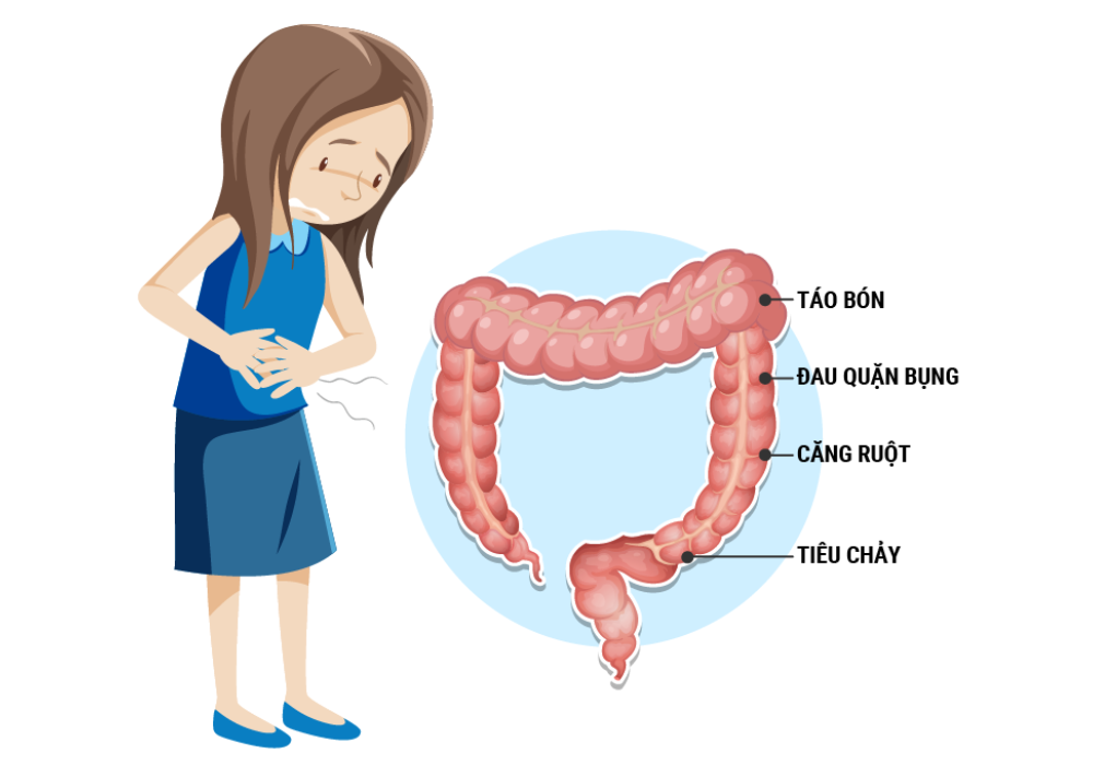 IBS có những triệu chứng gần giống với viêm đại tràng
