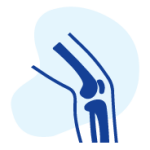 Tìm hiểu về bệnh lý cơ xương khớp