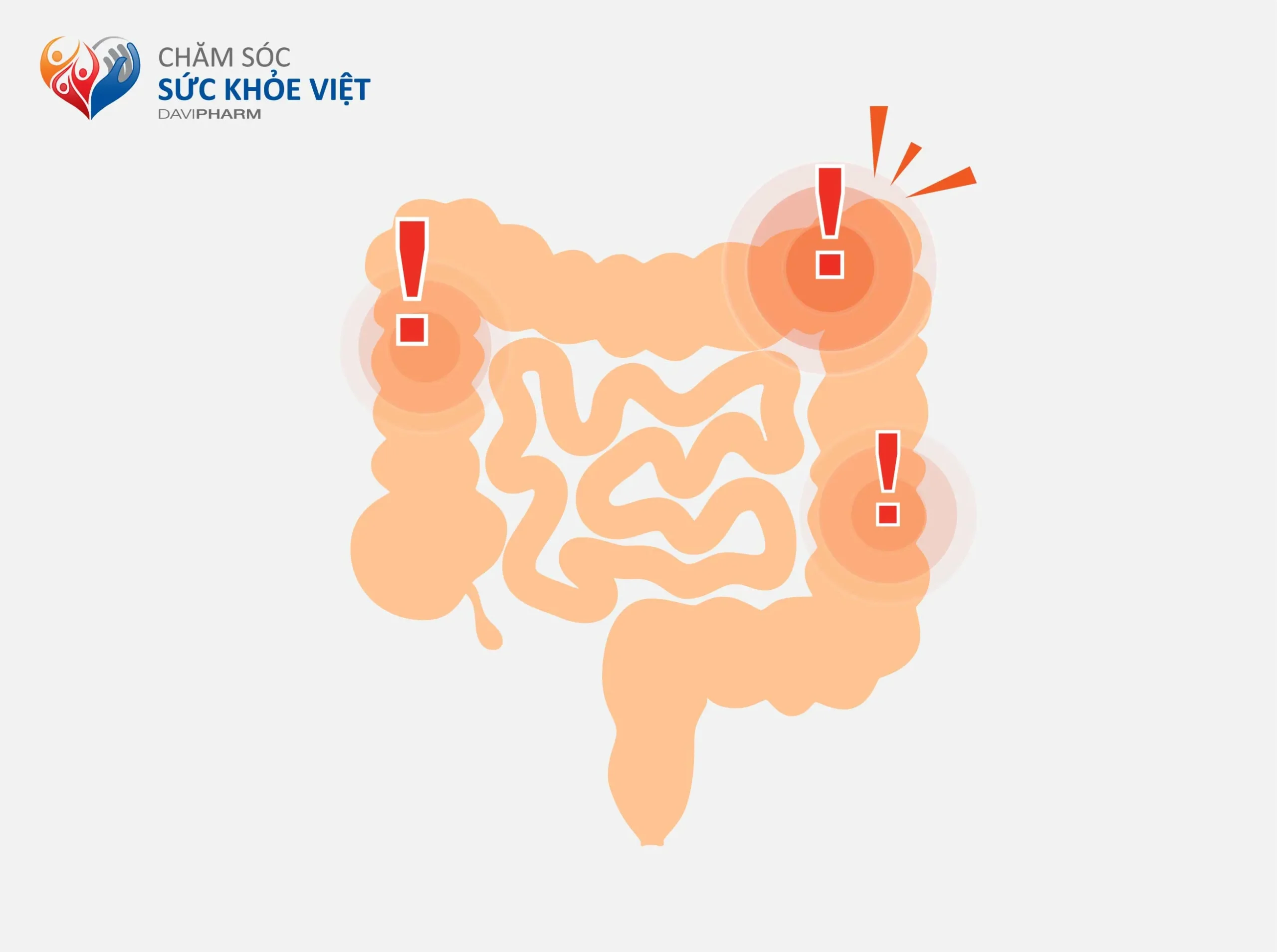 NÊN VÀ KHÔNG NÊN LÀM GÌ KHI MẮC HỘI CHỨNG RUỘT KÍCH THÍCH (IBS) ?