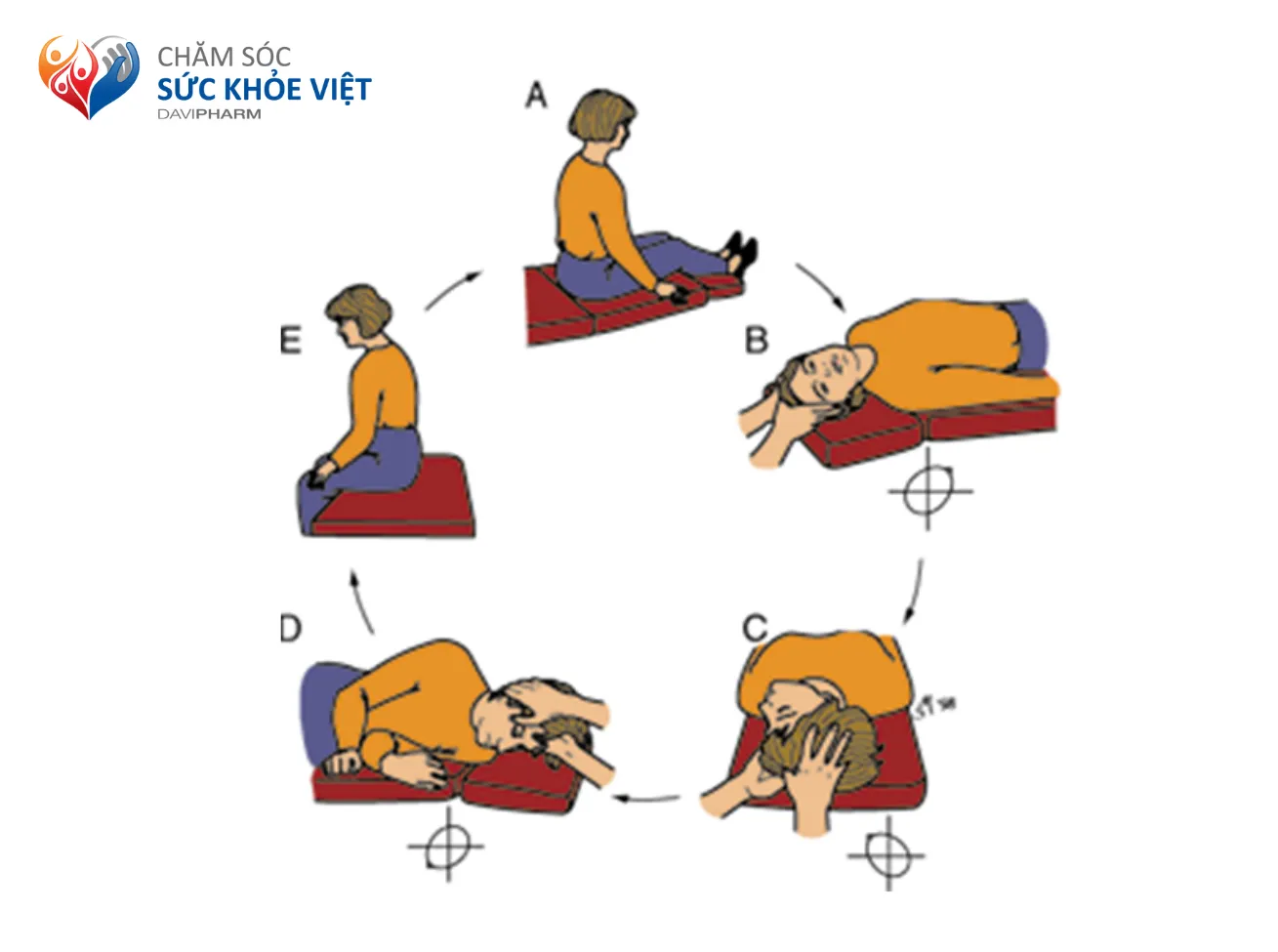 Liệu pháp Epley – phương pháp tái định vị sỏi tai phổ biến
