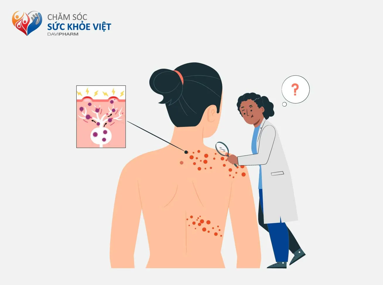 NHẬN BIẾT BỆNH ĐAU THẦN KINH SAU ZONA VÀ CÁCH ĐIỀU TRỊ