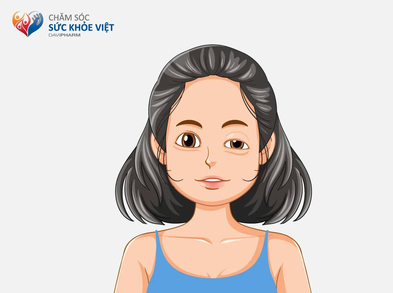 SỤP MI, YẾU CƠ NHANH CHÓNG – DẤU HIỆU CỦA BỆNH LÝ NHƯỢC CƠ