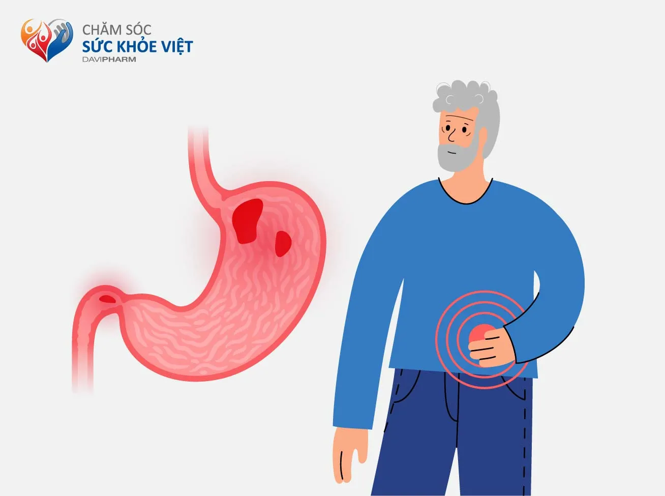 VIÊM LOÉT DẠ DÀY Ở NGƯỜI CAO TUỔI