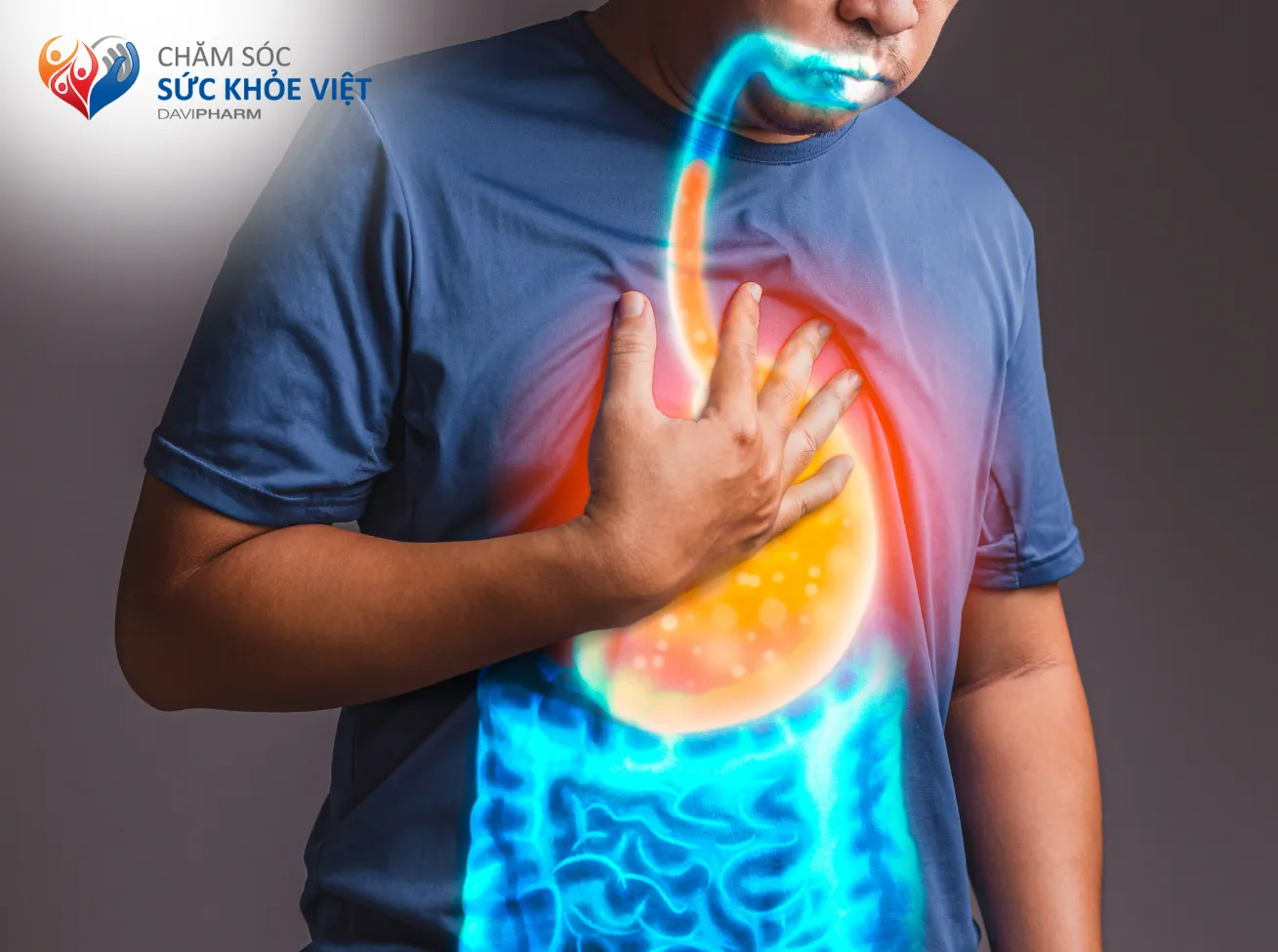 Trào ngược dạ dày thực quản (GERD) là tình trạng acid trào ngược từ dạ dày lên thực quản