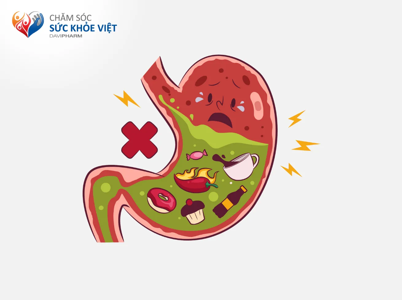 Bệnh nhân GERD cần tránh các thức ăn cay nóng và kích thích