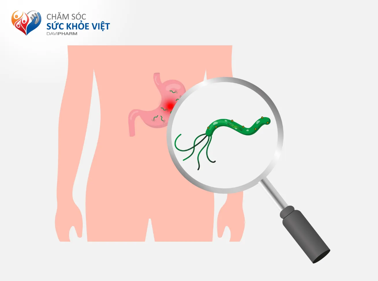 Helicobacter pylori là thủ phạm gây viêm loét dạ dày