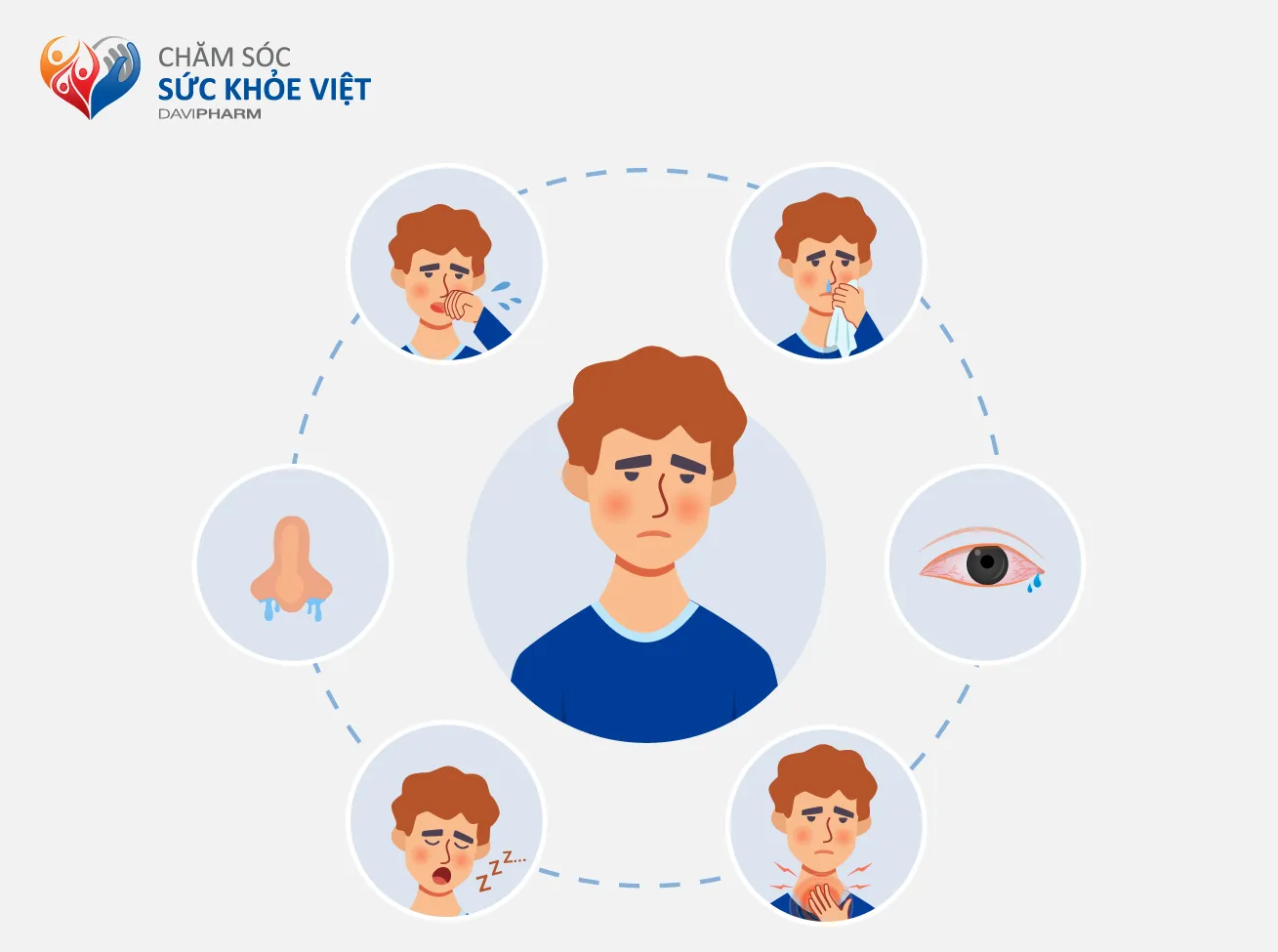 Các triệu chứng thường gặp của viêm mũi dị ứng như hắt hơi, ngứa mũi, chảy nước mũi, nghẹt mũi và ngứa mắt.