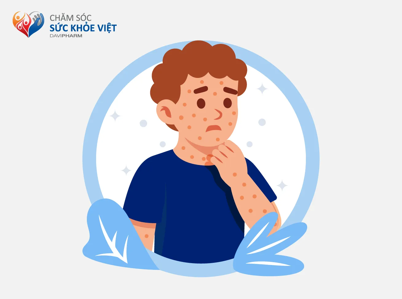 Tự ý dùng thuốc đông y để “chữa tận gốc” mày đay.