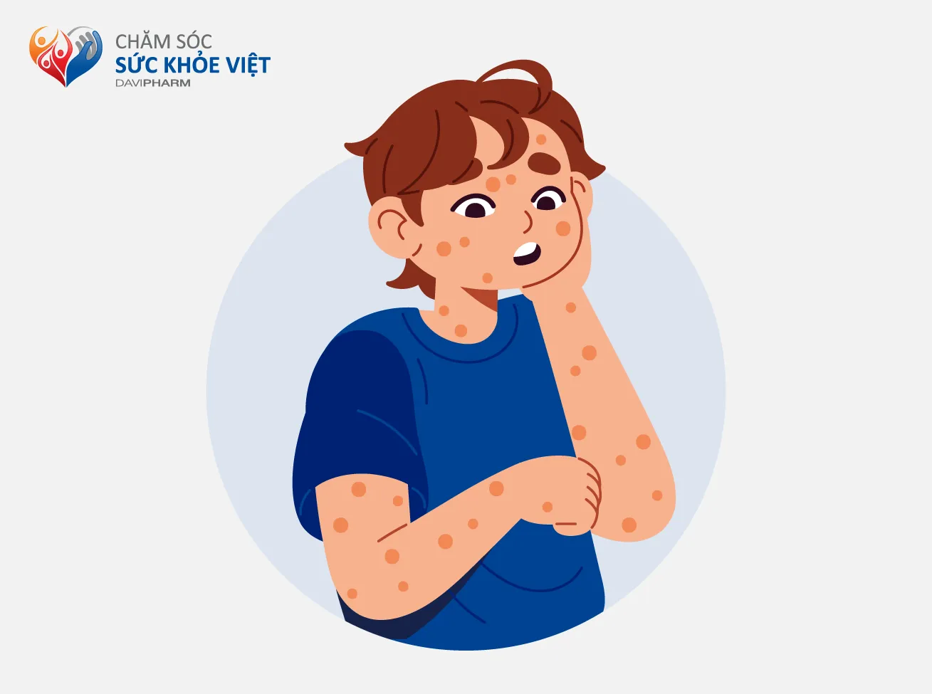Dị ứng sau khi ăn hải sản hoặc dùng thuốc.
